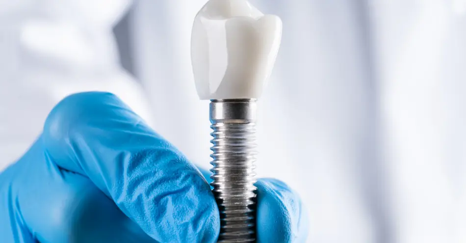 Implantes de carga inmediata en Chamberí — EDA Clínica Dental, Santa Engracia 15
