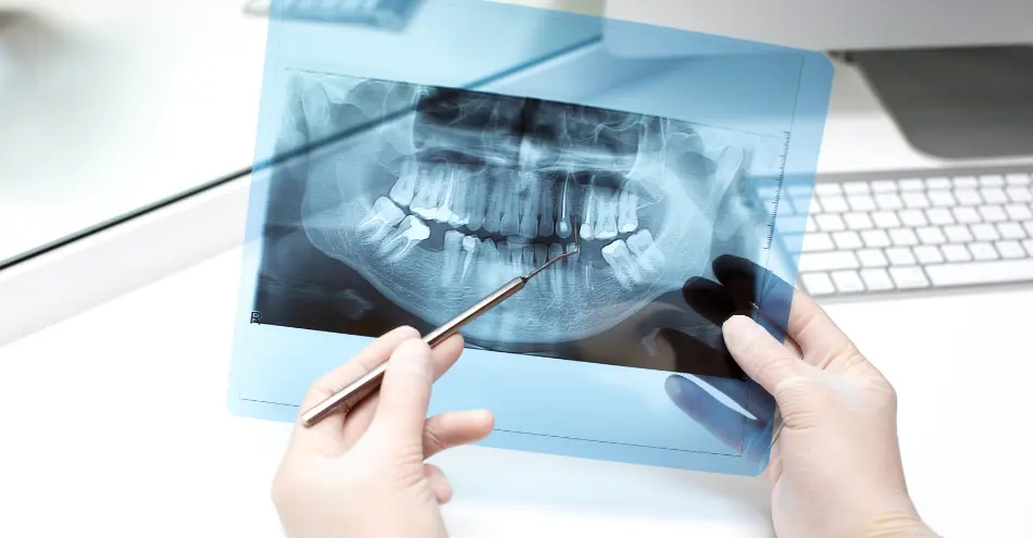 Prótesis fija provisional el mismo día de la cirugía de implantes