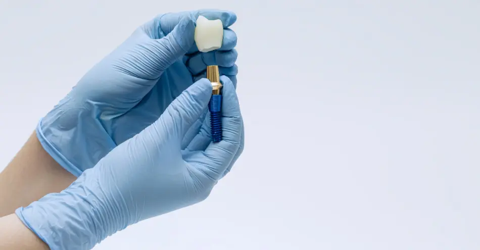 Valoración para implantes de carga inmediata en Chamberí (Madrid)