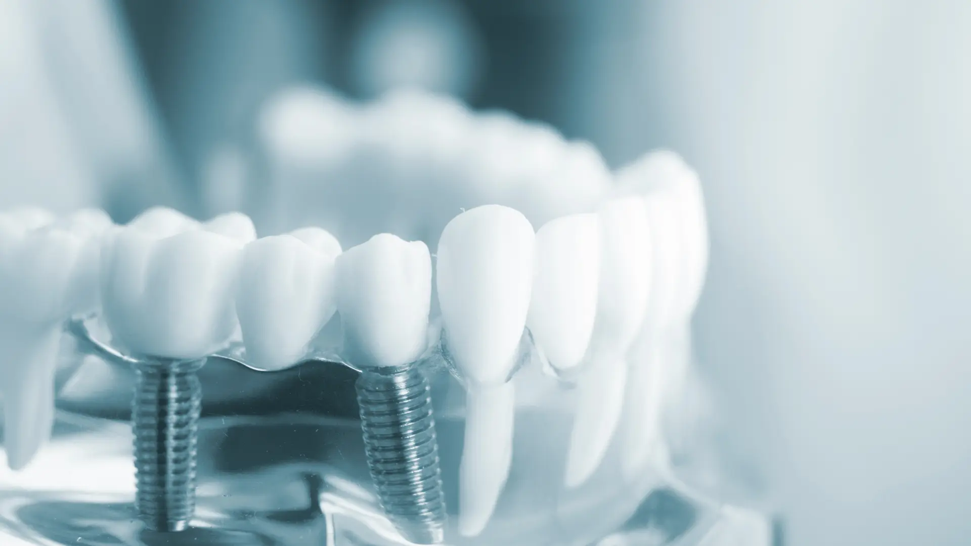 Cirugía maxilofacial y tratamiento de la ATM en Chamberí — EDA Clínica Dental