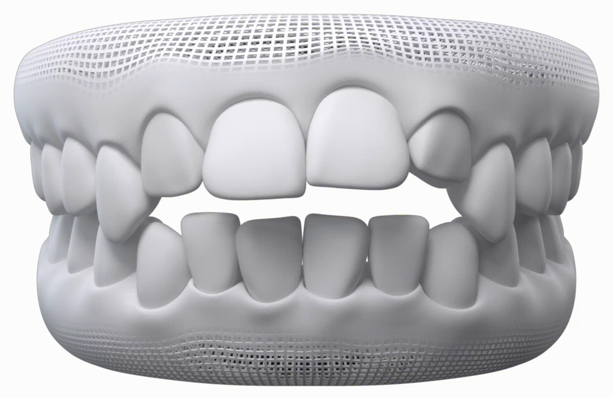 Dientes de leche — Invisalign en Chamberí