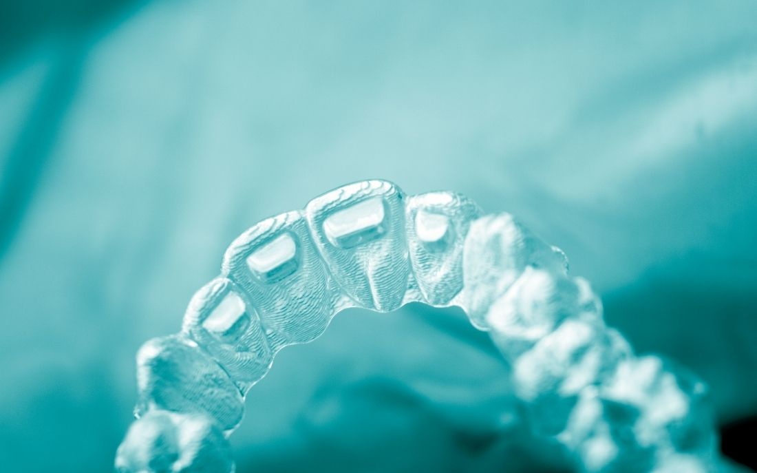 Proceso Invisalign en Madrid