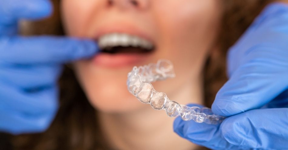 Tipos de brackets en Chamberí