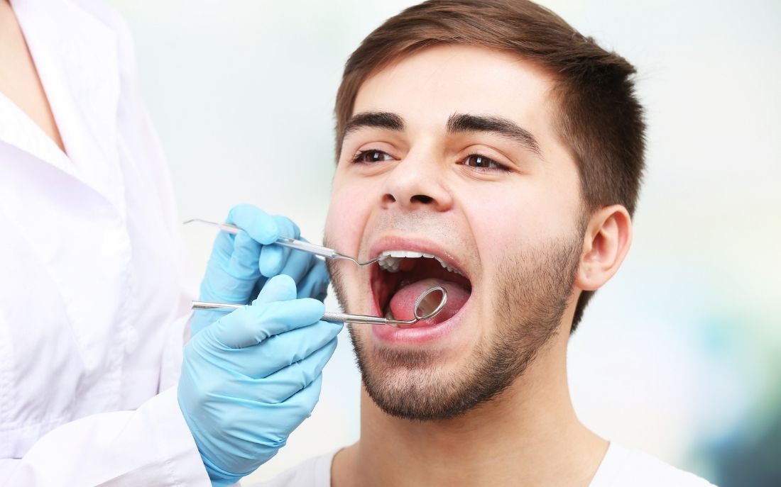 Gingivitis
