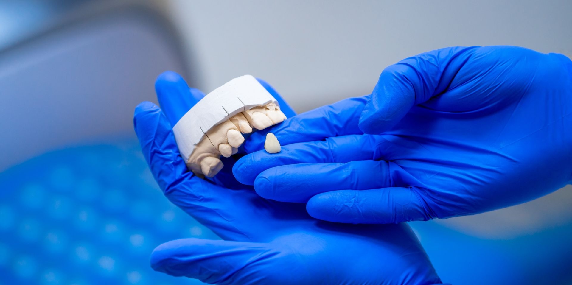 Prótesis Dentales — EDA Clínica Dental